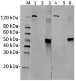 SaCas9 Antibody in Western Blot (WB)