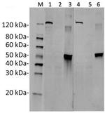 SaCas9 Antibody in Western Blot (WB)
