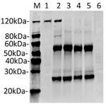 SaCas9 Antibody in Immunoprecipitation (IP)