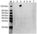 SaCas9 Antibody in Western Blot (WB)