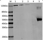 SaCas9 Antibody in Western Blot (WB)