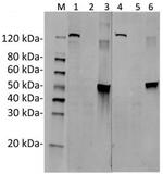 SaCas9 Antibody in Western Blot (WB)