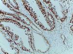MSH6 Antibody in Immunohistochemistry (Paraffin) (IHC (P))