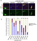 GFP Antibody in Immunocytochemistry (ICC/IF)
