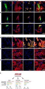 GFP Antibody in Immunocytochemistry (ICC/IF)
