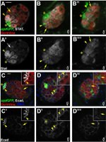 GFP Antibody in Immunocytochemistry (ICC/IF)
