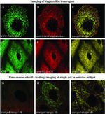 GFP Antibody in Immunocytochemistry (ICC/IF)