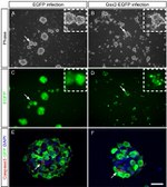 GFP Antibody in Immunocytochemistry (ICC/IF)