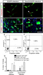 GFP Antibody in Immunocytochemistry (ICC/IF)