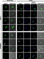 GFP Antibody in Immunocytochemistry (ICC/IF)
