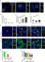 GFP Antibody in Immunocytochemistry (ICC/IF)