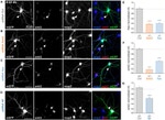 GFP Antibody in Immunocytochemistry (ICC/IF)
