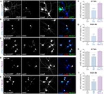 GFP Antibody in Immunocytochemistry (ICC/IF)