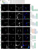 GFP Antibody in Immunocytochemistry (ICC/IF)