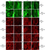 alpha Tubulin Antibody in Immunohistochemistry (IHC)