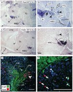 beta Galactosidase Antibody in Immunohistochemistry (Paraffin) (IHC (P))