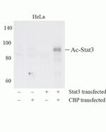 Acetyl-Stat3 (Lys685) Antibody in Western Blot (WB)