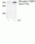 Phospho-53BP1 (Ser1778) Antibody in Western Blot (WB)