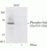Phospho-Syk (Tyr525, Tyr526) Antibody in Western Blot (WB)