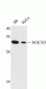 SOCS3 Antibody in Western Blot (WB)