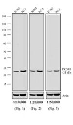 Rabbit IgG (H+L) Highly Cross-Adsorbed Secondary Antibody in Western Blot (WB)