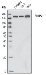 SHIP2 Antibody in Western Blot (WB)