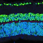 Phospho-NMDAR1 (Ser890) Antibody in Immunohistochemistry (IHC)