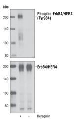 Phospho-ErbB4 (Tyr984) Antibody in Western Blot (WB)