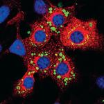 LNPEP Antibody in Immunocytochemistry (ICC/IF)