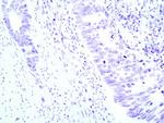 Plexin-A1 Antibody in Immunohistochemistry (Paraffin) (IHC (P))