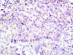 Plexin-A1 Antibody in Immunohistochemistry (Paraffin) (IHC (P))