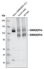 GABBR1 Antibody in Western Blot (WB)