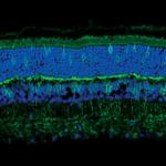 GLT-1 Antibody in Immunohistochemistry (IHC)