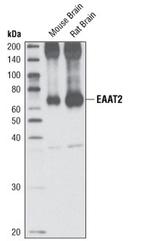 GLT-1 Antibody in Western Blot (WB)