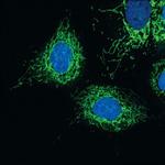 MAVS Antibody in Immunocytochemistry (ICC/IF)