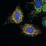 MAVS Antibody in Immunocytochemistry (ICC/IF)