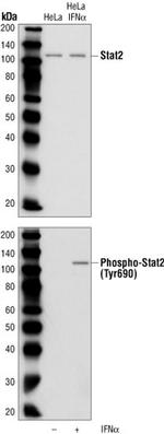 Phospho-STAT2 (Tyr690) Antibody in Western Blot (WB)