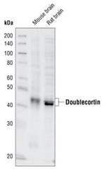 Doublecortin Antibody in Western Blot (WB)