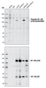 Phospho-NFkB p52 (Ser866, Ser870) Antibody in Western Blot (WB)