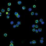 Phospho-CD79a (Tyr182) Antibody in Immunocytochemistry (ICC/IF)