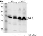 IkB beta Antibody in Western Blot (WB)