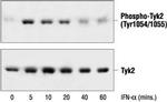 Phospho-Tyk2 (Tyr1054, Tyr1055) Antibody in Western Blot (WB)