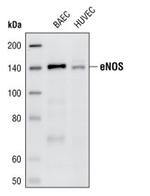 eNOS Antibody in Western Blot (WB)