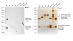 Human IgG (H+L) Cross-Adsorbed Secondary Antibody in Western Blot (WB)