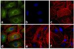 Rat IgG (H+L) Cross-Adsorbed Secondary Antibody in Immunocytochemistry (ICC/IF)