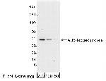 AU5 Tag Polyclonal Antibody
