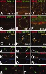 HuC/HuD Antibody in Immunohistochemistry (IHC)