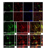 HuC/HuD Antibody in Immunohistochemistry (IHC)