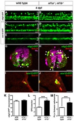 HuC/HuD Antibody in Immunohistochemistry (IHC)
