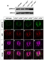 HuC/HuD Antibody in Immunohistochemistry (IHC)